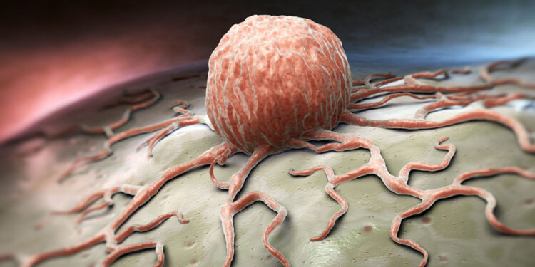 ক্যানসার প্রতিরোধে ছয় ধরনের খাবার