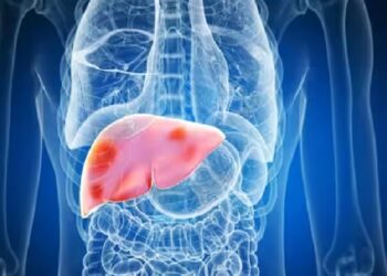 লিভার সুস্থ রাখতে এড়িয়ে চলবেন যেসব খাবার