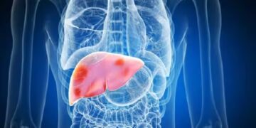 লিভার সুস্থ রাখতে এড়িয়ে চলবেন যেসব খাবার