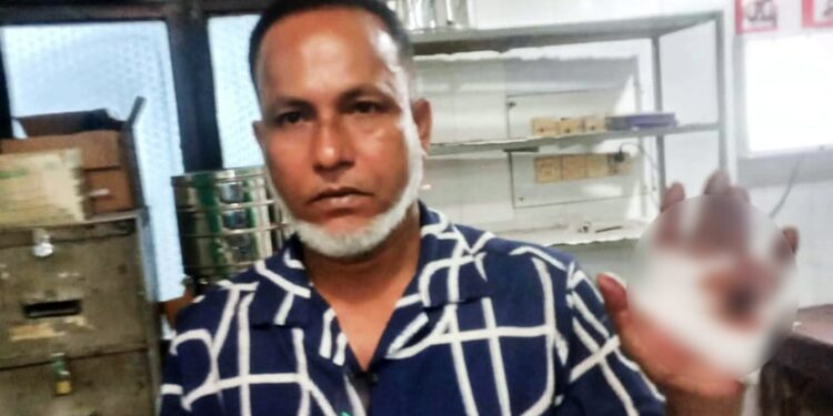 কলাবাগানে দুর্বৃত্তের গুলিতে বিএনপি নেতা আহত