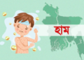 হামের উপসর্গ নিয়ে সিলেটে একদিনে তিন শিশুর মৃত্যু